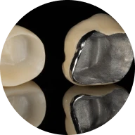 <a href='/usluge/krunice/metalokeramicke-krunice'>Metalokeramičke krunice</a>