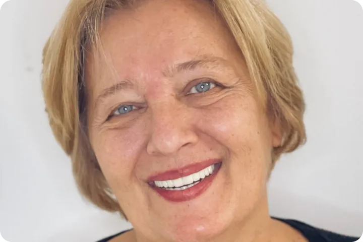 All-on-6 before and after images