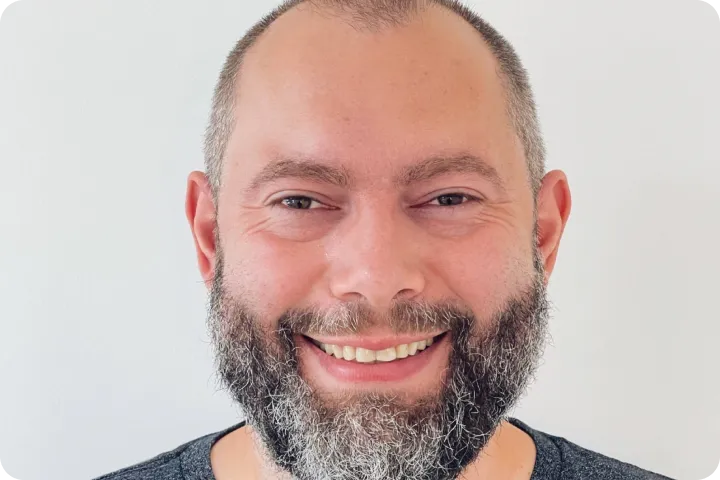 Hollywood smile before and after images