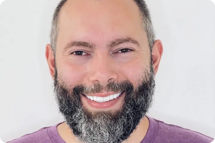 Hollywood smile before and after images