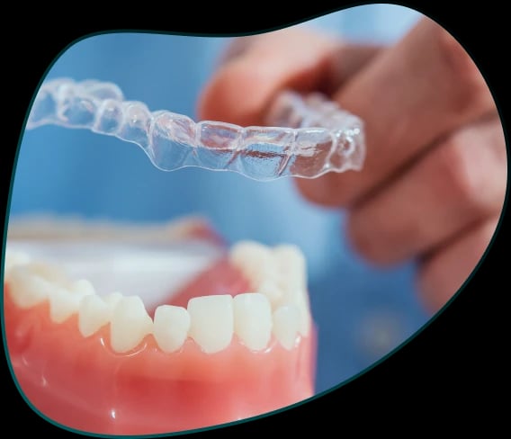 Folije za ispravljanje zuba