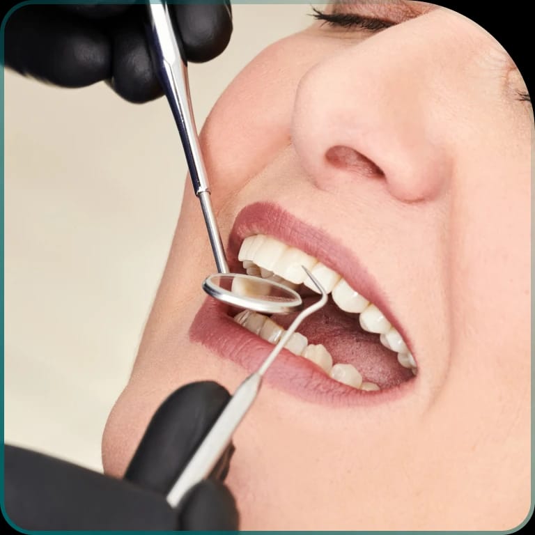 Ugradnja implanta zuba - kako se ugrađuju zubni implanti?